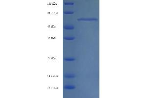 SDS-PAGE (SDS) image for Mixed Lineage Kinase Domain-Like (MLKL) (AA 1-471), (full length) protein (His tag) (ABIN5714442)