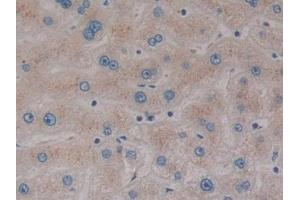 Detection of SP140 in Human Liver Tissue using Polyclonal Antibody to Sp140 Nuclear Body Protein (SP140) (SP140 antibody  (AA 443-655))