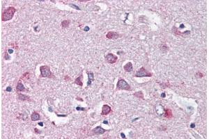 Human Brain, Cortex (formalin-fixed, paraffin-embedded) stained with NF2 antibody ABIN337064 at 5 ug/ml followed by biotinylated anti-goat IgG secondary antibody ABIN481715, alkaline phosphatase-streptavidin and chromogen. (Merlin antibody  (AA 526-536))