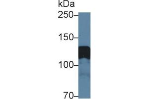 Detection of AMPH in Rat Cerebrum lysate using Polyclonal Antibody to Amphiphysin (AMPH)