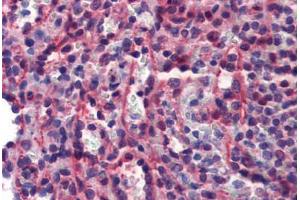 Human Spleen (formalin-fixed, paraffin-embedded) stained with CASP7 antibody ABIN462356 followed by biotinylated anti-mouse IgG secondary antibody ABIN481714, alkaline phosphatase-streptavidin and chromogen. (Caspase 7 antibody)