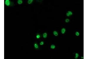 Anti-TP53 mouse monoclonal antibody (ABIN2454617) immunofluorescent staining of COS7 cells transiently transfected by pCMV6-ENTRY TP53 (RC200003). (p53 antibody)