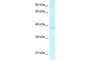 WB Suggested Anti-Aebp2 Antibody   Titration: 1. (AEBP2 antibody  (C-Term))