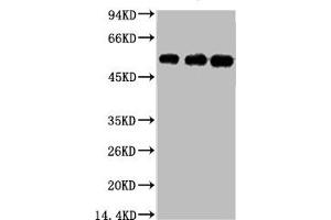 Western blot analysis of 1) Hela, 2) Mouse Brain tissue, 3) Rat Brain tissue, diluted at 1:5000. (TUBB3 antibody)