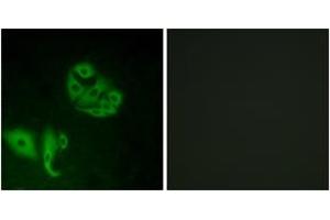 Immunofluorescence analysis of A549 cells, using GPR20 Antibody. (GPR20 antibody  (AA 291-340))