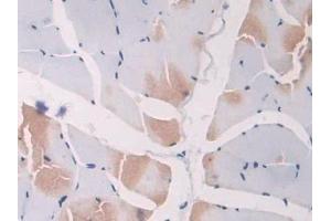 DAB staining on IHC-P; Samples: Rat Skeletal muscle Tissue (SCGN antibody  (AA 1-276))