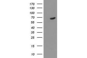 HEK293T cells were transfected with the pCMV6-ENTRY control (Left lane) or pCMV6-ENTRY TDP1 (Right lane) cDNA for 48 hrs and lysed. (TDP1 antibody)