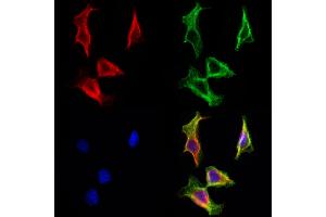 ABIN6263468 and ABIN6272966 staining Hela cells by IF/ICC.