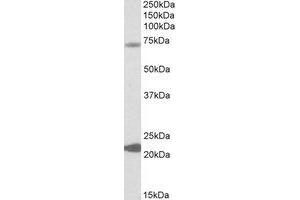 Western Blotting (WB) image for anti-Potassium Intermediate/small Conductance Calcium-Activated Channel, Subfamily N, Member 2 (KCNN2) (Internal Region) antibody (ABIN2464352) (KCNN2 antibody  (Internal Region))