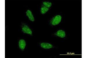 Immunofluorescence of monoclonal antibody to PIM1 on HeLa cell.