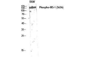 Western Blotting (WB) image for anti-Insulin Receptor Substrate 1 (IRS1) (pSer636) antibody (ABIN3182047) (IRS1 antibody  (pSer636))
