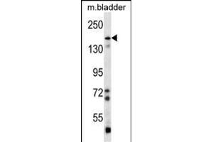 BAI1 Antibody  (ABIN392804 and ABIN2842241) western blot analysis in mouse bladder tissue lysates (35 μg/lane).