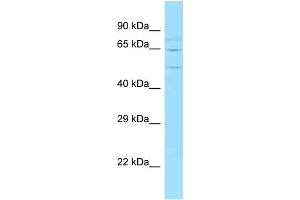 WB Suggested Anti-Wasf2 Antibody   Titration: 1.