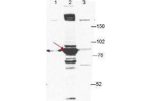 Anti-ESRP-1 by western blot shows detection of ESRP-1 in transfected 293T cell extracts (lane 2, arrowhead). (ESRP1 antibody)