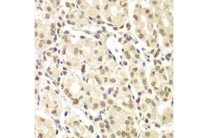 Immunohistochemistry of paraffin-embedded human gastric using ULK4 antibody (ABIN5975557) at dilution of 1/100 (40x lens). (ULK4 antibody)