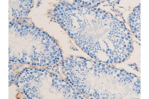 ABIN6267068 at 1/100 staining mouse testis tissue sections by IHC-P. (Smooth Muscle Actin antibody  (N-Term))