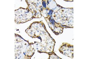 Immunohistochemistry of paraffin-embedded human placenta using TLR3 Rabbit pAb (ABIN6130066, ABIN6149219, ABIN6149220 and ABIN6215465) at dilution of 1:100 (40x lens). (TLR3 antibody  (AA 464-647))