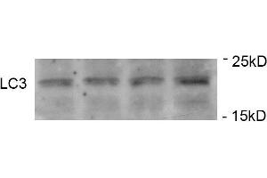 Western Blotting (WB) image for anti-Microtubule-Associated Protein 1 Light Chain 3 gamma (MAP1LC3C) (pSer12) antibody (ABIN389699)