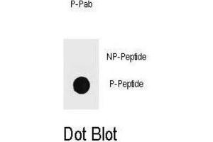 Dot Blot (DB) image for anti-Topoisomerase (DNA) II Binding Protein 1 (TOPBP1) (pSer1138) antibody (ABIN3001953) (TOPBP1 antibody  (pSer1138))