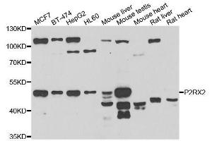 Western blot analysis of extracts of various cell lines, using P2RX2 antibody. (P2RX2 antibody  (AA 60-320))