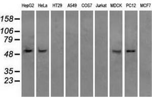 Western blot analysis of extracts (35 µg) from 9 different cell lines by using anti-ATP5B monoclonal antibody.