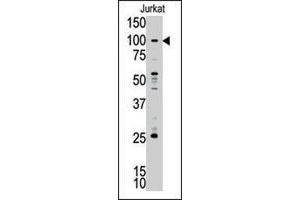 Western blot analysis of MLLT10 polyclonal antibody  in Jurkat cell lysate. (MLLT10 antibody  (C-Term))