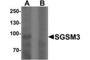 Western blot analysis of SGSM3 in 293 cell lysate with SGSM3 Antibody  at 1 ug/mL in (A) the absence and (B) the presence of blocking peptide. (SGSM3 antibody  (N-Term))