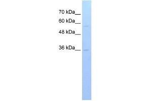 RFPL3 antibody used at 1 ug/ml to detect target protein. (RFPL3 antibody  (C-Term))