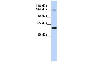 WB Suggested Anti-EDC4 Antibody Titration: 0. (EDC4 antibody  (N-Term))
