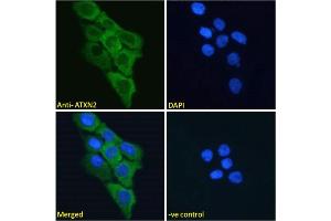 ABIN570879 Immunofluorescence analysis of paraformaldehyde fixed A431 cells, permeabilized with 0. (Ataxin 2 antibody  (Internal Region))