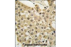 Immunohistochemistry (Paraffin-embedded Sections) (IHC (p)) image for anti-Mdm2, p53 E3 Ubiquitin Protein Ligase Homolog (Mouse) (MDM2) (AA 141-176) antibody (ABIN388067)