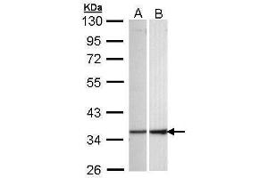 WB Image Sample (30 ug of whole cell lysate) A: 293T B: Hep G2 , 10% SDS PAGE antibody diluted at 1:1000 (ECHS1 antibody)
