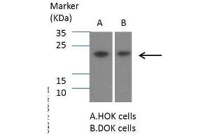 WB Image Sample (30 ug of whole cell lysate) A: Hep G2 , 12% SDS PAGE antibody diluted at 1:1000 (SOCS1 antibody  (C-Term))