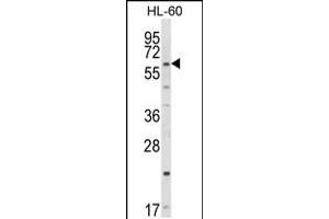 Western blot analysis of CYP51A1 Antibody in HL-60 cell line lysates (35ug/lane)