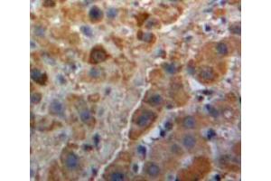Used in DAB staining on fromalin fixed paraffin-embedded Liver tissue (PLG antibody  (AA 582-812))