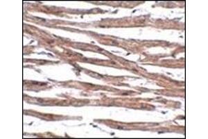 Immunohistochemistry of MAK10 in human heart tissue with this product at 5 μg/ml. (MAK10/NAA35 antibody  (Center))