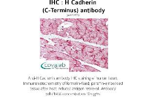 Image no. 1 for anti-Cadherin 13 (CDH13) (C-Term) antibody (ABIN5693589) (Cadherin 13 antibody  (C-Term))
