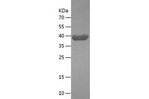 ANXA6 Protein (AA 324-673) (His tag)