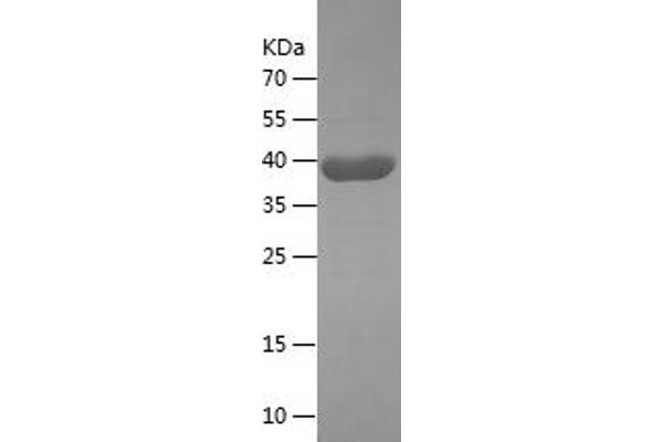 ANXA6 Protein (AA 324-673) (His tag)