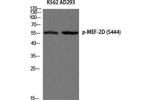 Western Blot (WB) analysis of K562 AD293 using Phospho-MEF-2D (S444) antibody.