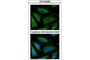 Image no. 3 for anti-Glyceraldehyde-3-Phosphate Dehydrogenase (GAPDH) antibody (ABIN467389) (GAPDH antibody)
