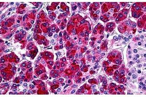 Human Pancreas: Formalin-Fixed, Paraffin-Embedded (FFPE) (SPINK1 antibody  (AA 24-80))