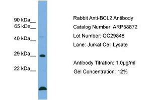 WB Suggested Anti-BCL2  Antibody Titration: 0.