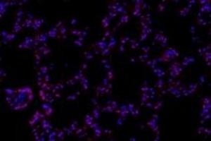 Immunofluorescence (fixed cells) (IF/ICC) image for anti-RNA Polymerase II Associated Protein 2 (RPAP2) antibody (ABIN7075481)