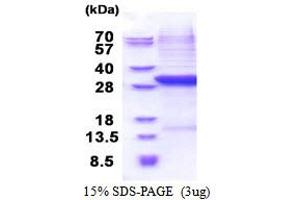 SDS-PAGE (SDS) image for Complement Factor B (CFB) (AA 26-259) protein (His tag) (ABIN5853522)