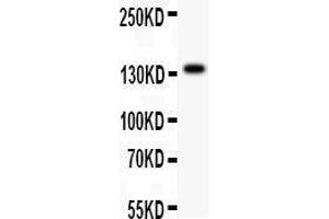 Western Blotting (WB) image for anti-Ataxin 2 (ATXN2) (AA 1283-1313), (C-Term) antibody (ABIN3043507) (Ataxin 2 antibody  (C-Term))