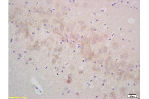 Formalin-fixed and paraffin embedded rat brain labeled with Rabbit Anti gamma Synuclein Polyclonal Antibody, Unconjugated (ABIN671001) at 1:200 followed by conjugation to the secondary antibody and DAB staining