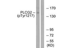 Western blot analysis of extracts from Jurkat cells treated with UV 15', using PLCG2 (Phospho-Tyr1217) Antibody. (Phospholipase C gamma 2 antibody  (pTyr1217))