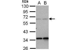 Western Blotting (WB) image for anti-Protein Phosphatase 4, Regulatory Subunit 2 (PPP4R2) (AA 1-360) antibody (ABIN1500387)