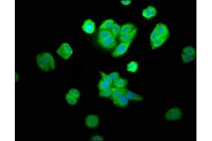 Immunofluorescence staining of HepG2 cells with ABIN7162391 at 1:100, counter-stained with DAPI. (CPOX antibody  (AA 19-149))